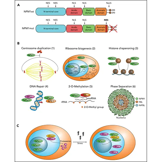 AML - Nucleophosmin (NPM1 ) Gene Mutation
